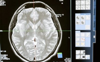De onvermijdelijke veranderingen van het geheugen begrijpen en omgaan met dementie